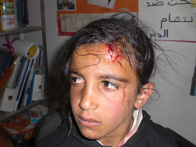 Une fillette palestinienne blessée par une attaque de colons israéliens